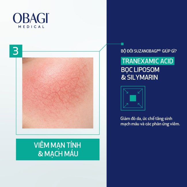 Da Nhạy Cảm Mãi Không Hết Nám? 3 Nguyên Nhân Khiến Nám Dai Dẳng