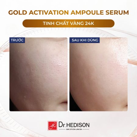 Huyết thanh vàng 24k Dr.Hedison Gold Activation Ampoule Serum