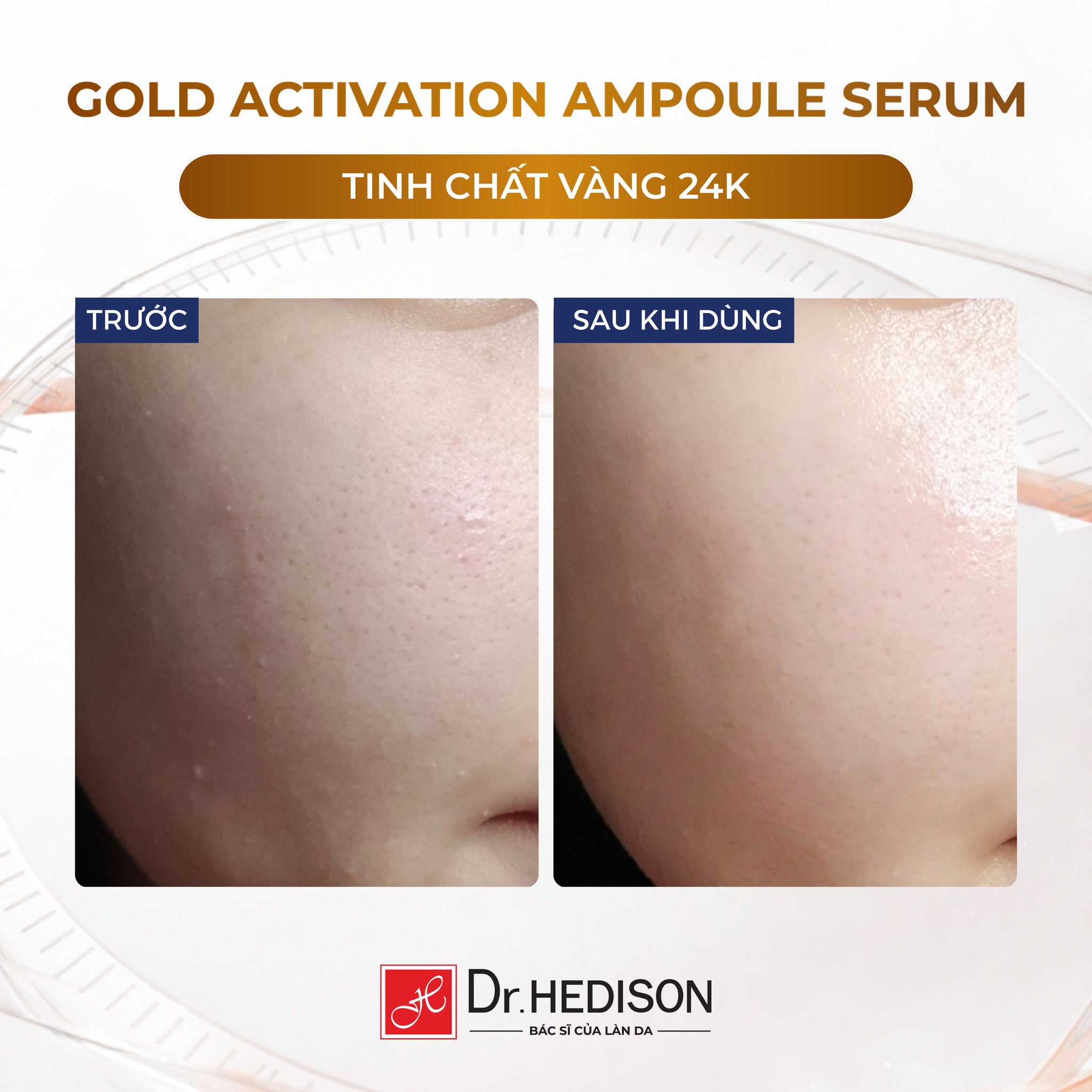 Huyết thanh vàng 24k Dr.Hedison Gold Activation Ampoule Serum
