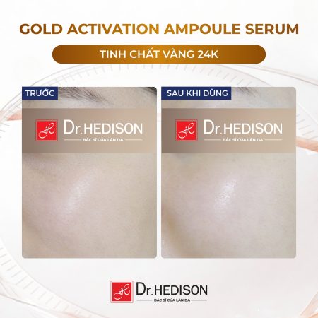 Huyết thanh vàng 24k Dr.Hedison Gold Activation Ampoule Serum