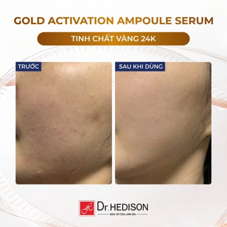 Huyết thanh vàng 24k Dr.Hedison Gold Activation Ampoule Serum