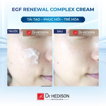 Kem dưỡng tái tạo tế bào gốc Dr.Hedison EGF Renewal Complex Cream