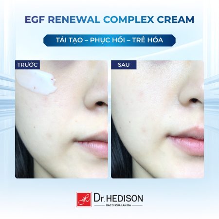 Kem dưỡng tái tạo tế bào gốc Dr.Hedison EGF Renewal Complex Cream