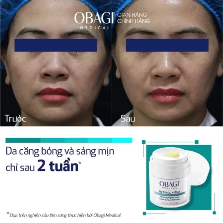 Kem dưỡng tái tạo trẻ hóa da ban đêm Obagi Medical Retinol + PHA