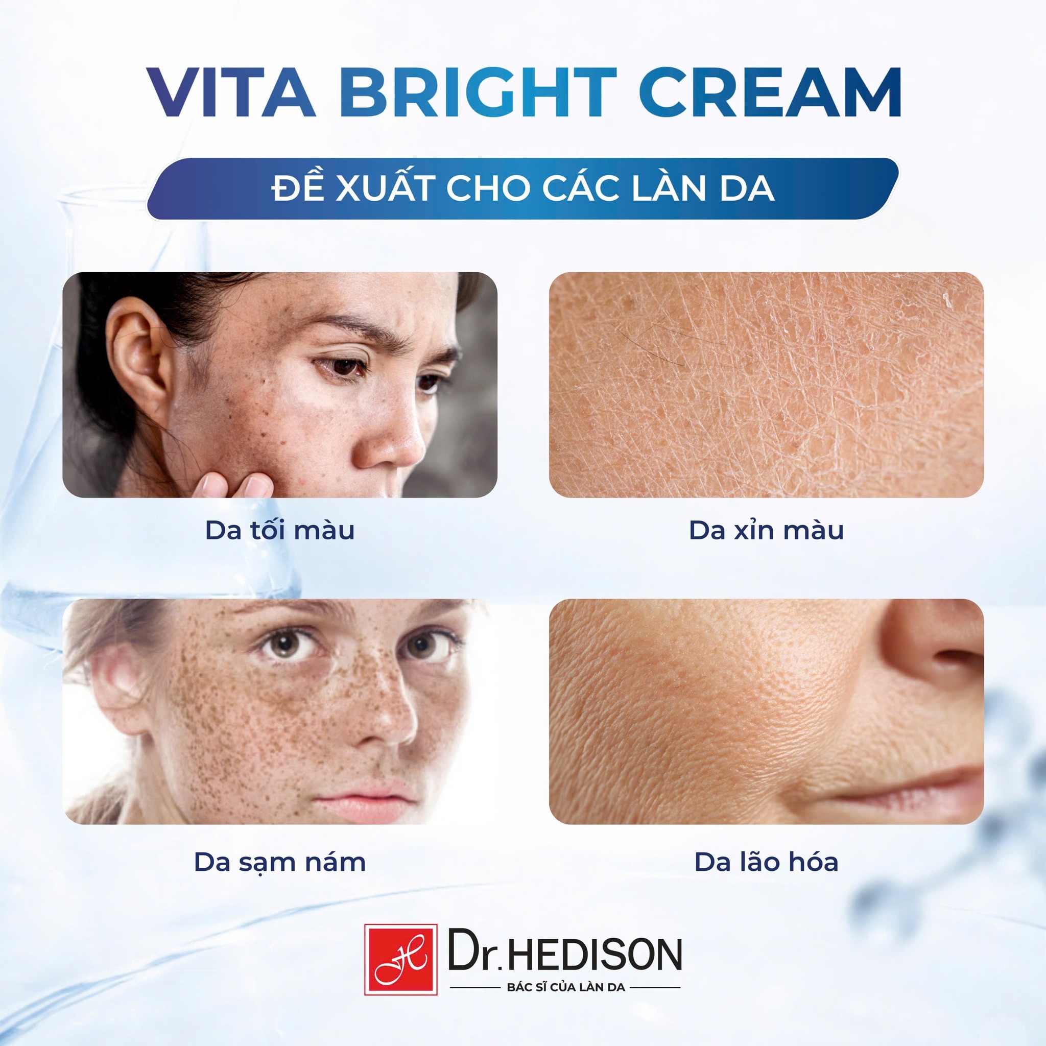 Kem dưỡng trắng da Dr.Hedison Vita – Bright Cream
