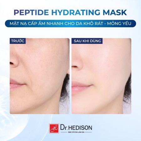 Mặt nạ giảm kích ứng Dr.Hedison Peptide Hydrating Mask (23gX10ea)