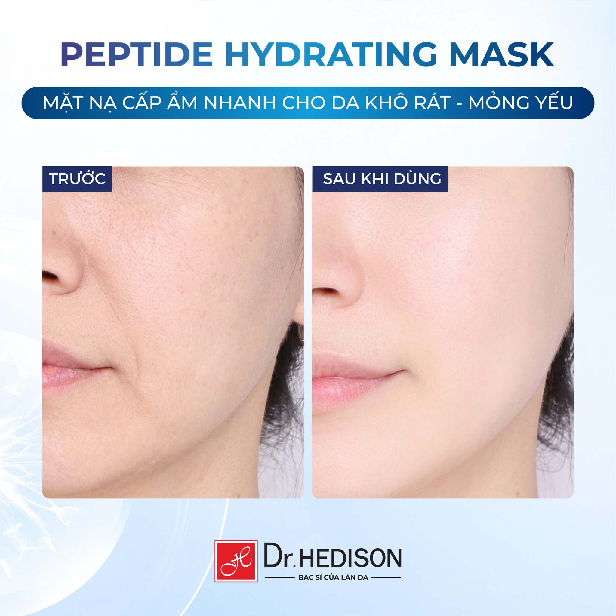 Mặt nạ giảm kích ứng Dr.Hedison Peptide Hydrating Mask (23gX10ea)