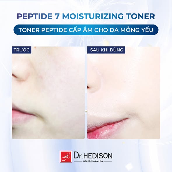 Nước hoa hồng giảm nếp nhăn Dr.Hedison Peptide 7 Moisturizing Toner