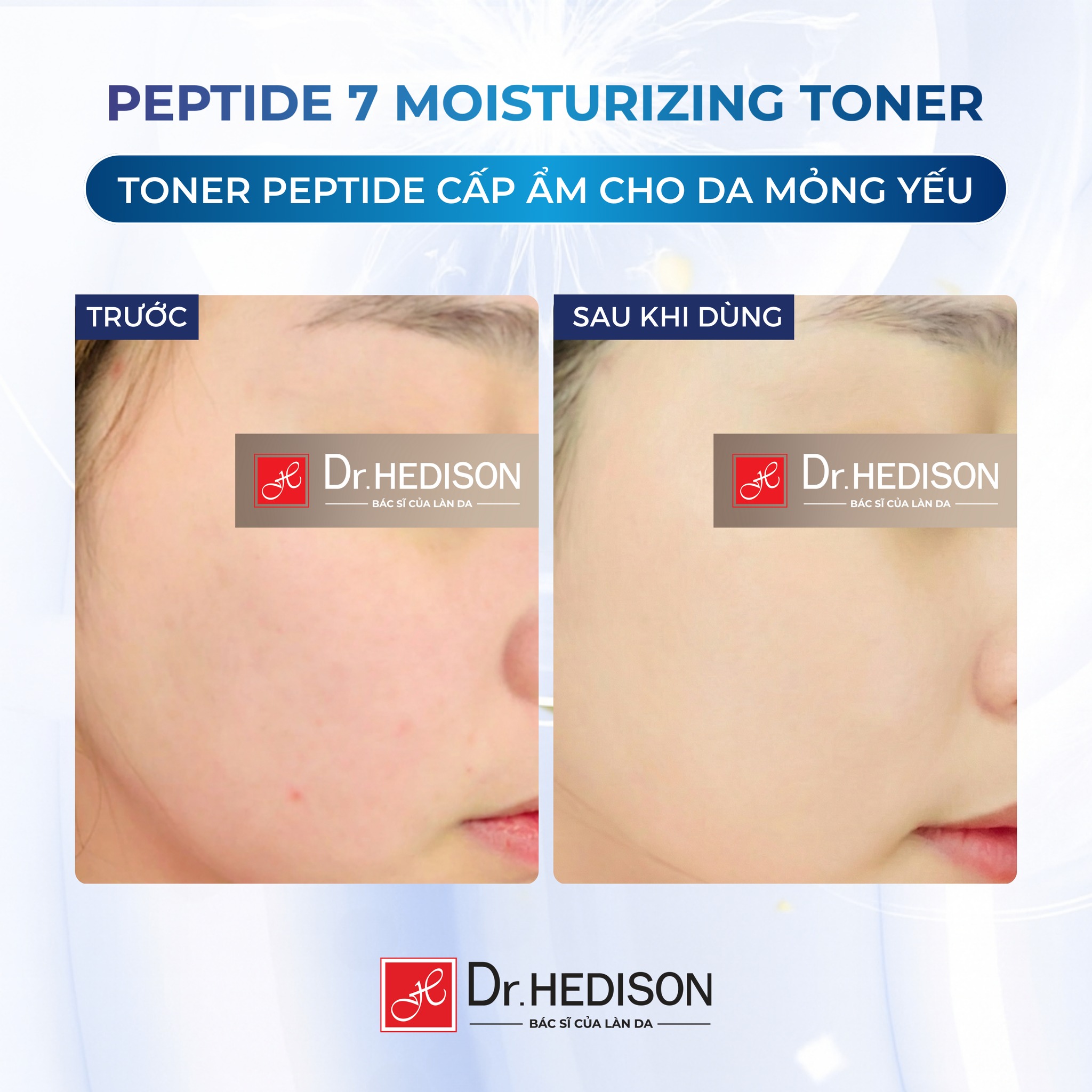 Nước hoa hồng giảm nếp nhăn Dr.Hedison Peptide 7 Moisturizing Toner