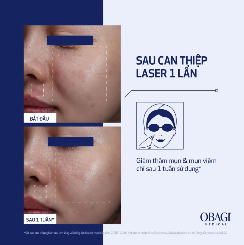Serum trẻ hoá da cấp độ tế bào Obagi NU-GEN™