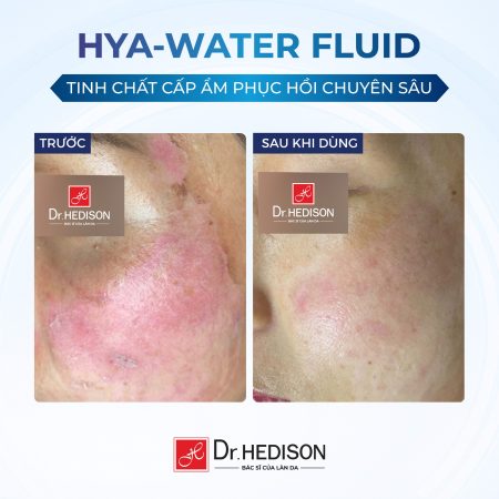 Tinh chất cấp nước dưỡng ẩm da Dr.Hedison Hya – Water Fluid