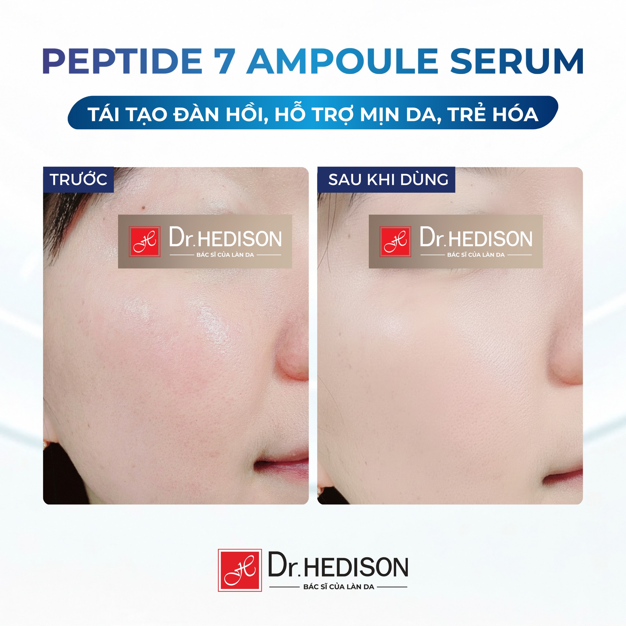Tinh chất giảm nếp nhăn Dr.Hedison Peptide 7 Ampoule Serum