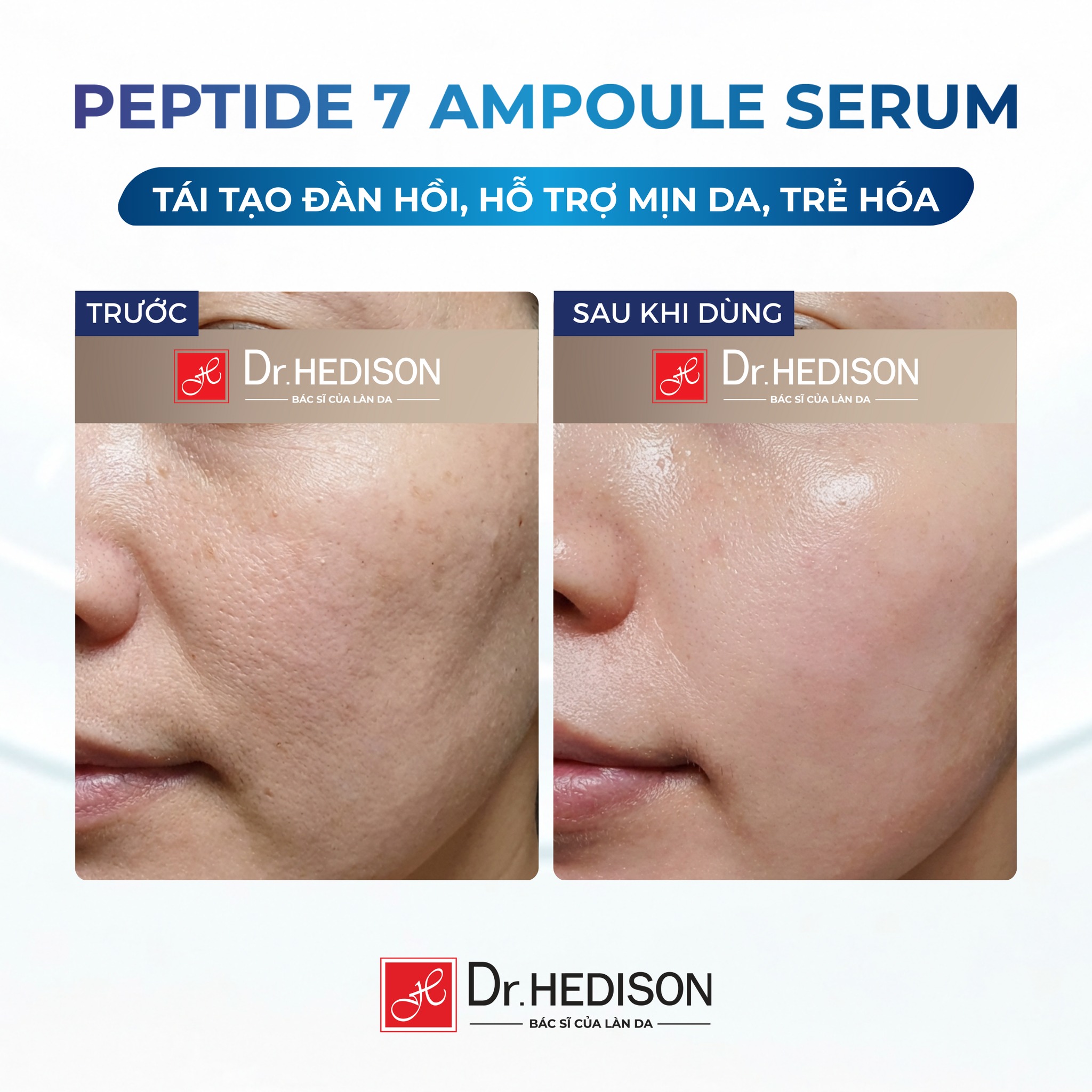 Tinh chất giảm nếp nhăn Dr.Hedison Peptide 7 Ampoule Serum