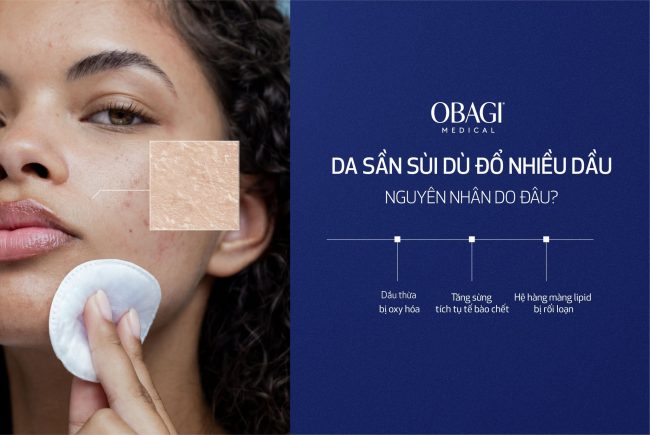 Chăm Da Đủ Kiểu Da Đã Dầu Nay Còn Dầu Hơn