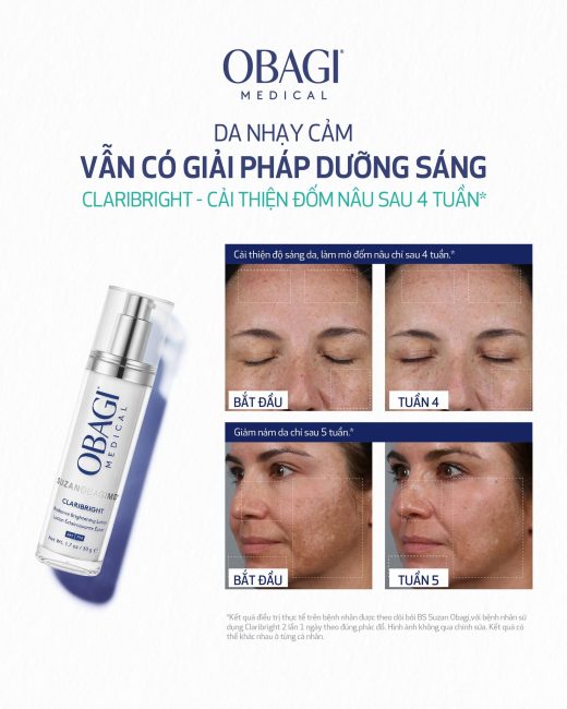 Lotion Dưỡng Sáng Obagi SUZANOBAGIMD® CLARIBRIGHT Có Giúp Mờ Thâm Mụn Không?